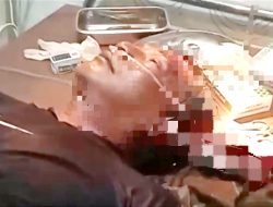 Tertusuk Moncong Ikan Marlin saat Menyelam, Nelayan Pamekasan Dilarikan ke RS di Surabaya